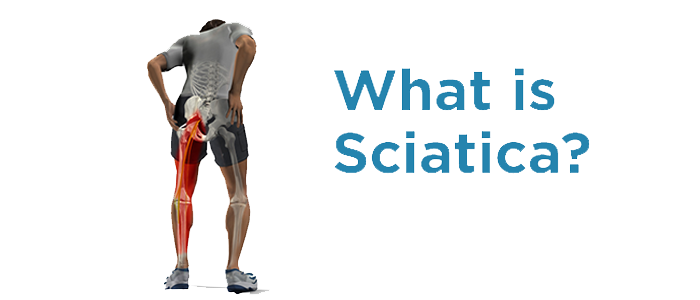 Sciatica nerve pain treatment